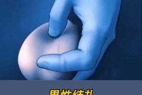 做手术大概需要多少钱 做手术需要多少钱张峰彬 简介