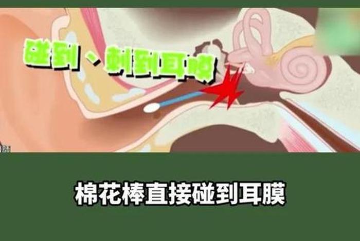 碘伏伤耳膜吗；碘伏伤耳膜吗有用吗