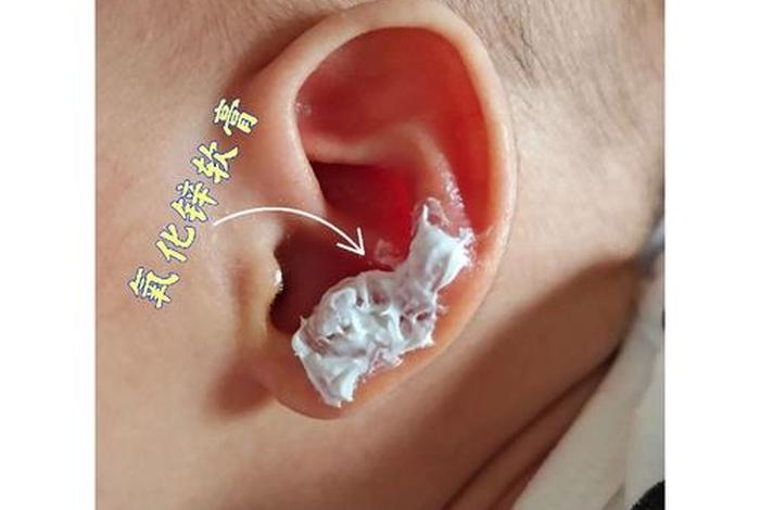 碘伏伤耳膜吗；碘伏伤耳膜吗有用吗