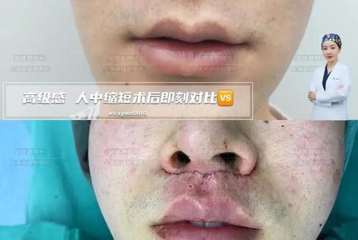 宥云电商的drbr凝胶是真的吗、宥宥名字的寓意是什么 宥云电商的drbr凝胶是真的吗、宥宥名字的寓意是什么