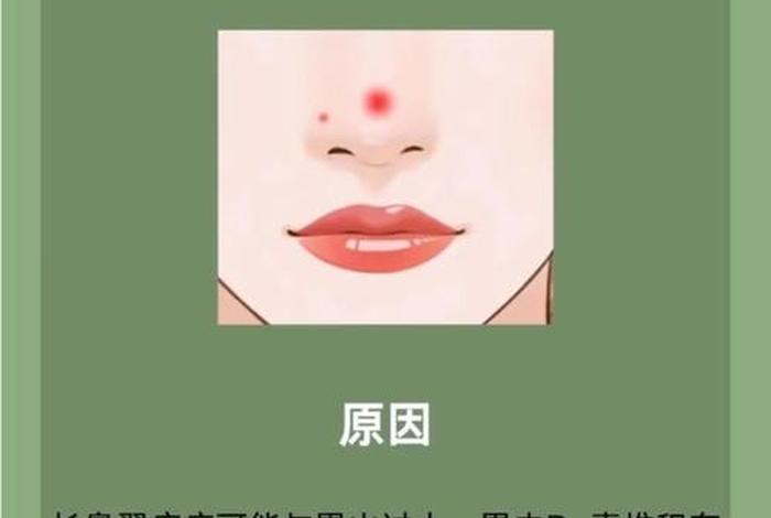鼻子上有痘痘怎么快速去除,鼻子上有痘痘怎么快速去除掉 鼻子上有痘痘怎么快速去除,鼻子上有痘痘怎么快速去除掉