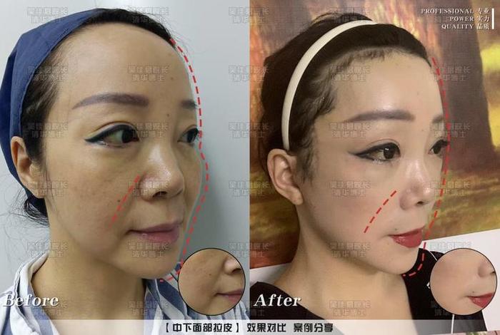 宥云电商的drbr凝胶是真的吗、宥宥名字的寓意是什么 宥云电商的drbr凝胶是真的吗、宥宥名字的寓意是什么